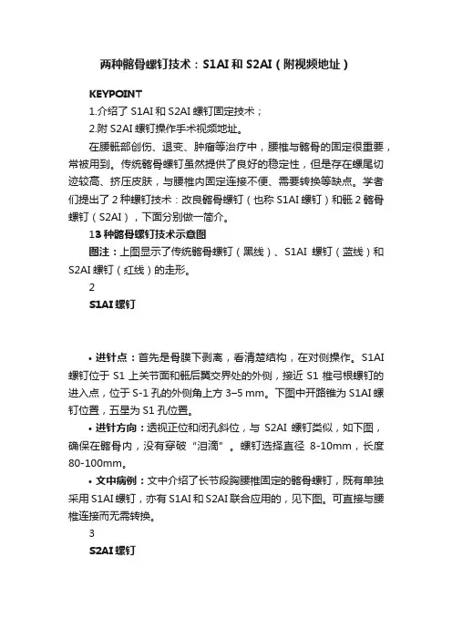 两种髂骨螺钉技术：S1AI和S2AI（附视频地址）