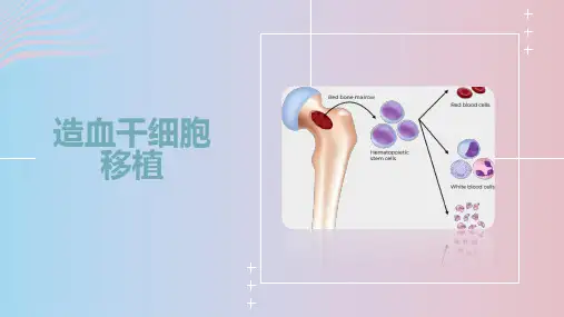 造血干细胞移植
