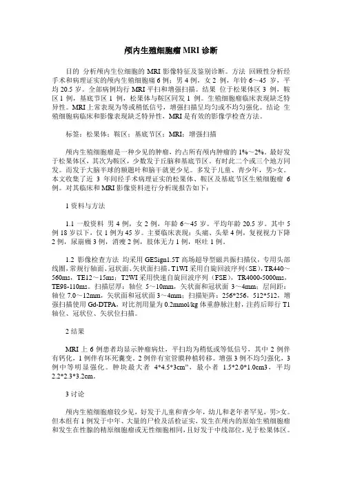 颅内生殖细胞瘤MRI诊断