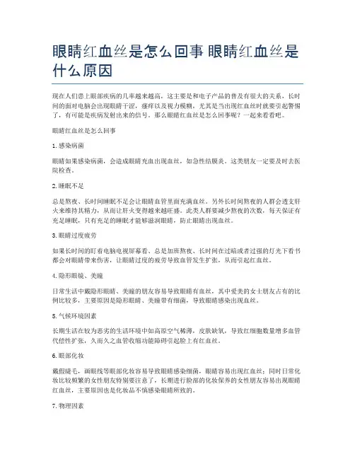 眼睛红血丝是怎么回事-眼睛红血丝是什么原因