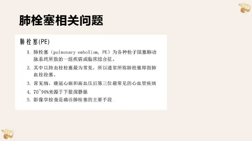 肺栓塞影像诊断