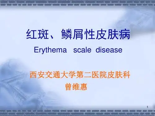 红斑、鳞屑性皮肤病.