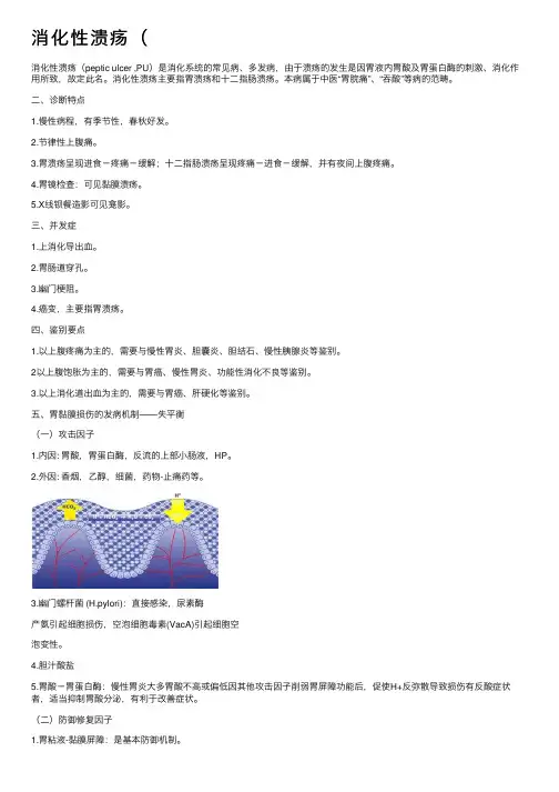 消化性溃疡（