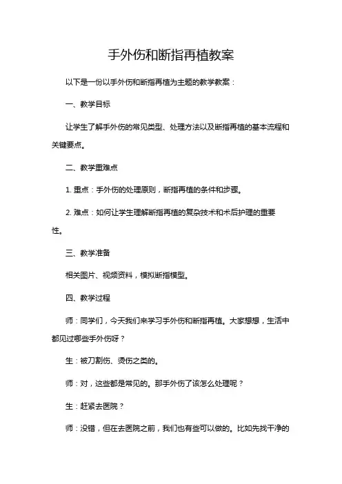 手外伤和断指再植教案