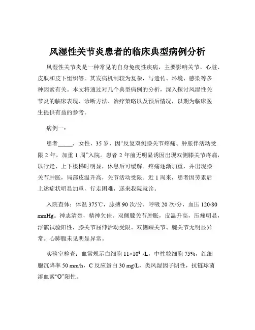 风湿性关节炎患者的临床典型病例分析