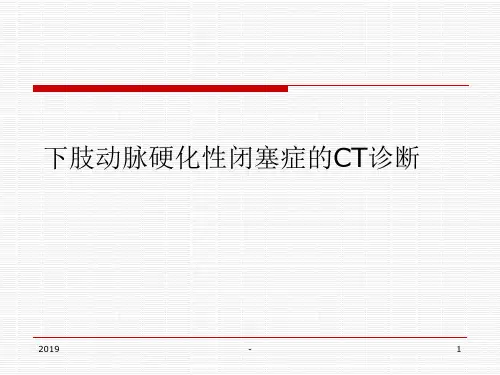 下肢动脉硬化性闭塞症的诊断ppt课件