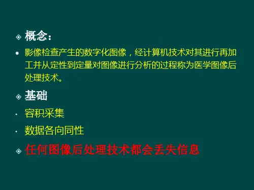 CT图像后处理技术知识讲解