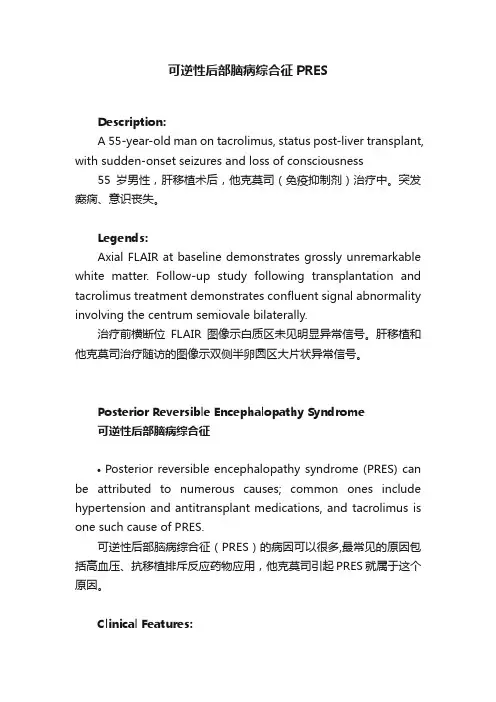 可逆性后部脑病综合征PRES