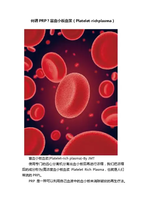 ?何谓PRP？富血小板血浆（Platelet-richplasma）