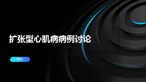 扩张型心肌病病例讨论范本