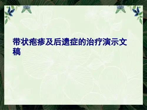 带状疱疹及后遗症的治疗演示文稿
