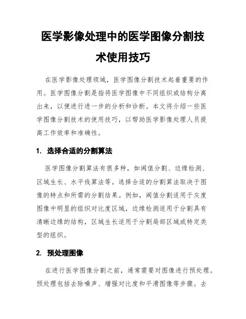 医学影像处理中的医学图像分割技术使用技巧