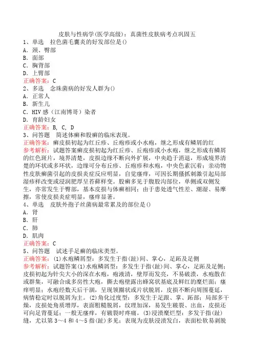 皮肤与性病学(医学高级)：真菌性皮肤病考点巩固五