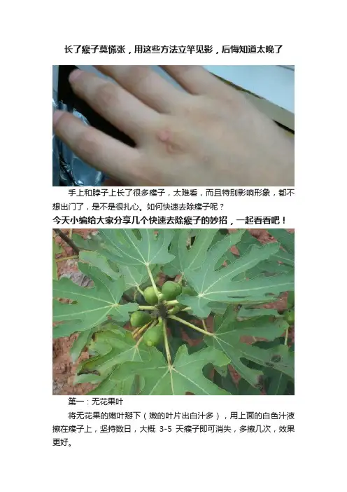 长了瘊子莫慌张，用这些方法立竿见影，后悔知道太晚了