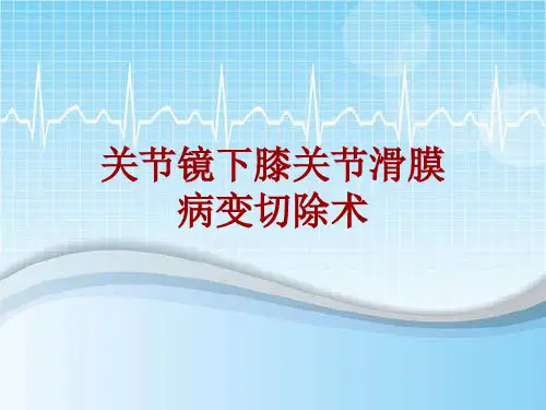 手术讲解模板：关节镜下膝关节滑膜病变切除术