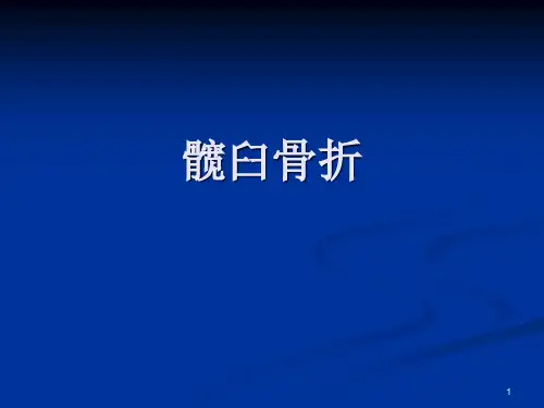 髋臼骨折PPT课件
