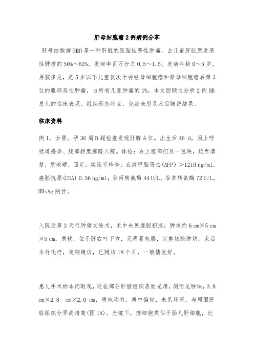 肝母细胞瘤2例病例分享