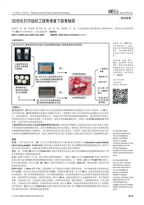 3D仿生打印组织工程骨修复下颌骨缺损