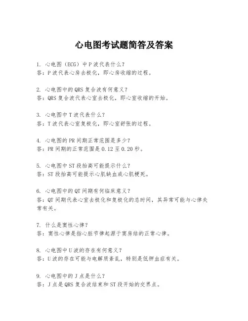 心电图考试题简答及答案