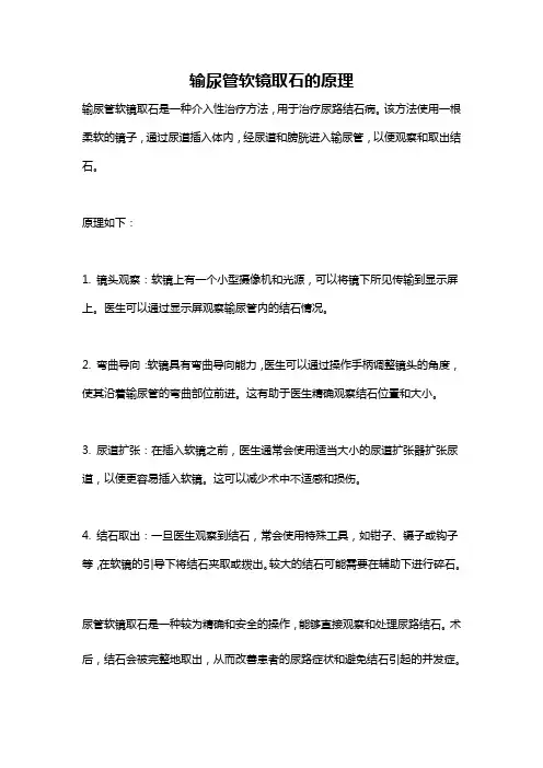 输尿管软镜取石的原理