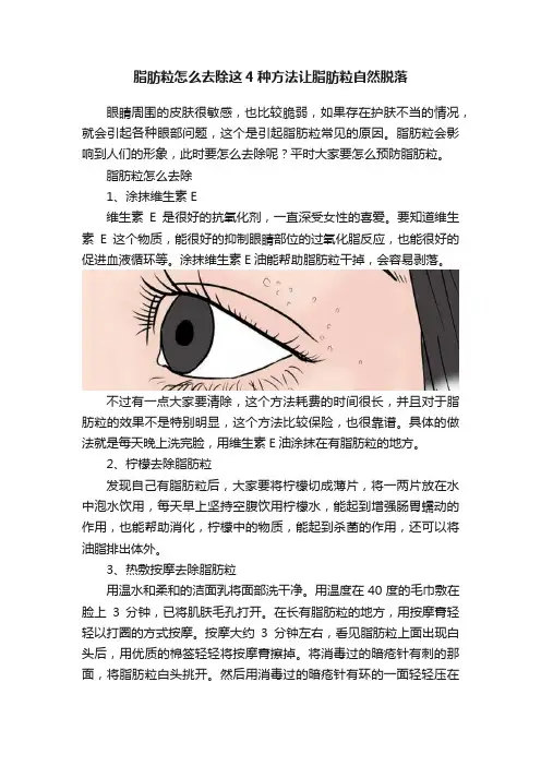 脂肪粒怎么去除这4种方法让脂肪粒自然脱落