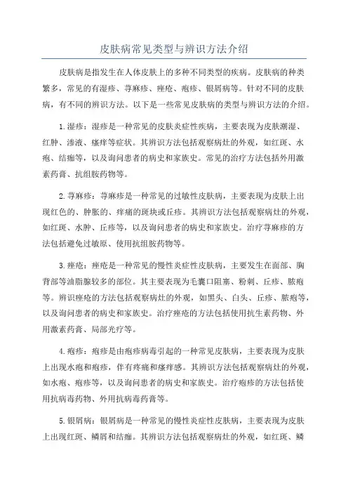 皮肤病常见类型与辨识方法介绍