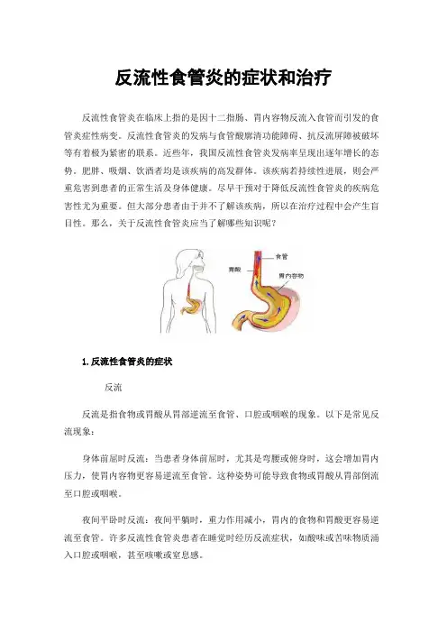 反流性食管炎的症状和治疗