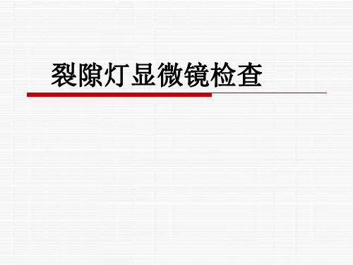 裂隙灯显微镜检