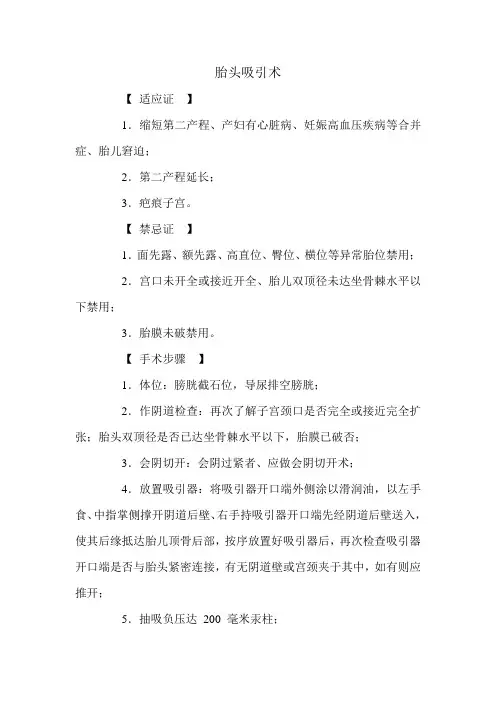 胎头吸引术