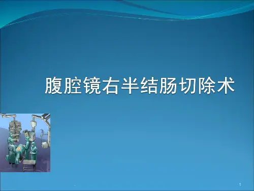 腹腔镜右半结肠切除术ppt演示课件