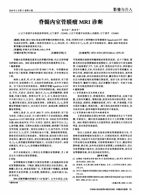 脊髓内室管膜瘤MRI诊断