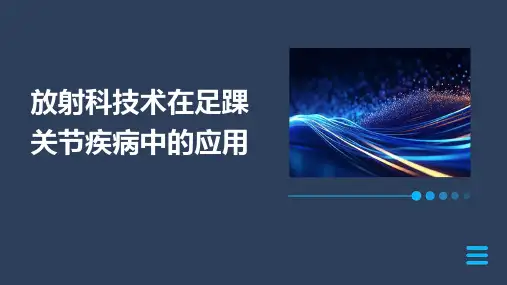 放射科技术在足踝关节疾病中的应用