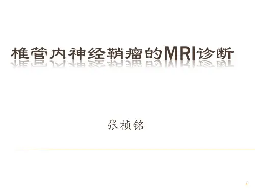 椎管内神经鞘瘤的MRI诊断参考PPT