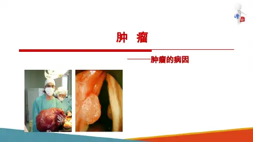 肿瘤的病因(病理学课件)