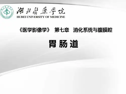 医学影像学胃肠道PPT