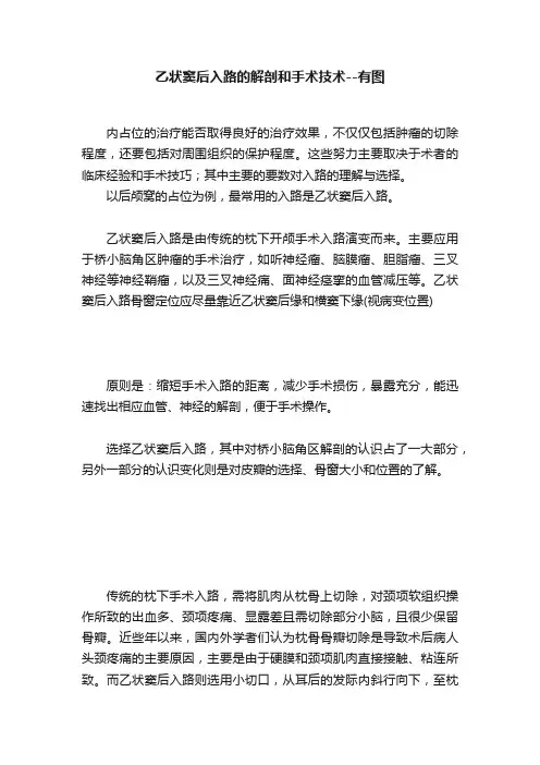 乙状窦后入路的解剖和手术技术--有图