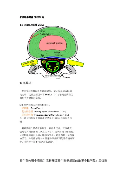 怎样看片子