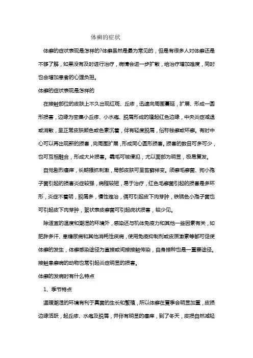 体癣的症状