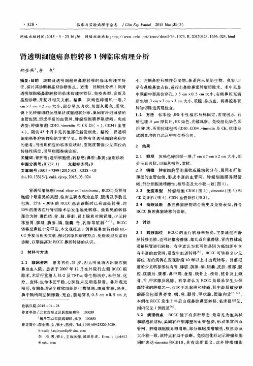 肾透明细胞癌鼻腔转移1例临床病理分析