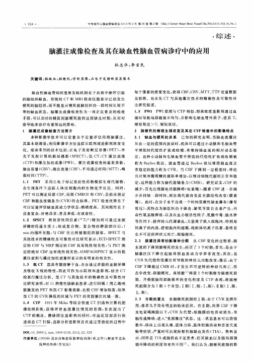 脑灌注成像检查及其在缺血性脑血管病诊疗中的应用
