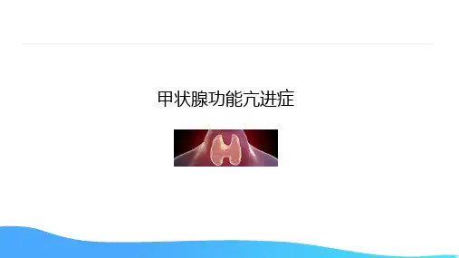 甲状腺功能亢进症