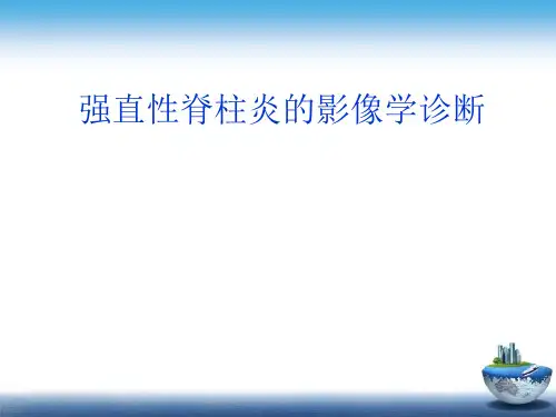 强直性脊柱炎的影像学诊断PPT5.5
