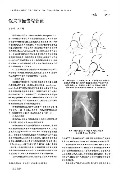 髋关节撞击综合征 (1)