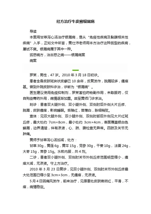 经方治疗牛皮癣银屑病