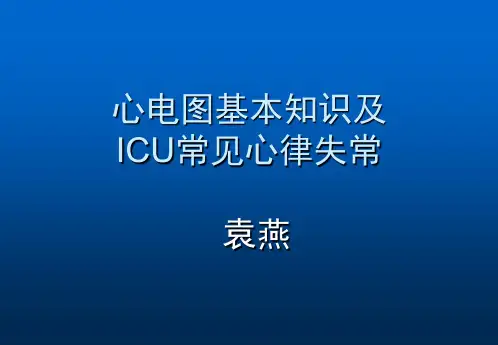 心电图基础知识