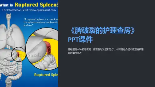 《脾破裂的护理查房》课件