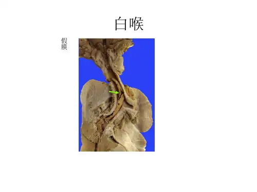 病理学-炎症