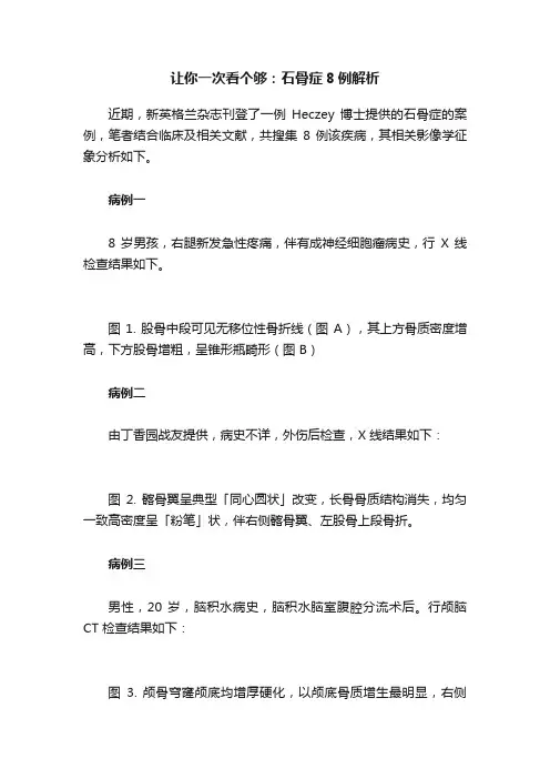 让你一次看个够：石骨症8例解析