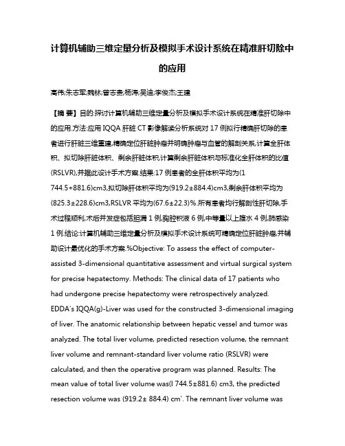 计算机辅助三维定量分析及模拟手术设计系统在精准肝切除中的应用