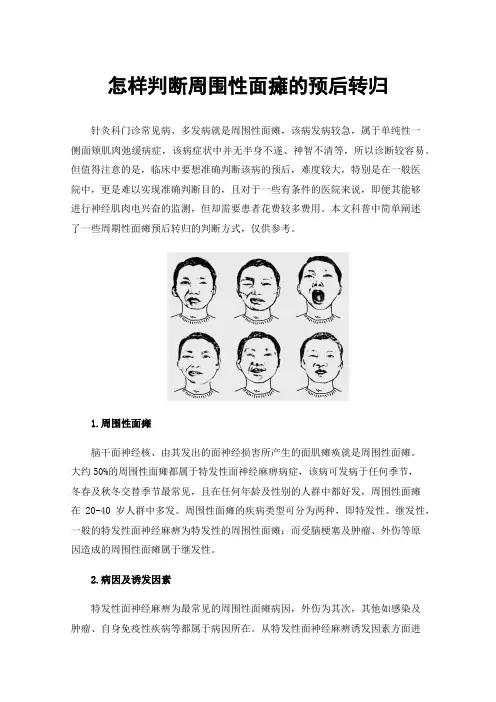 怎样判断周围性面瘫的预后转归